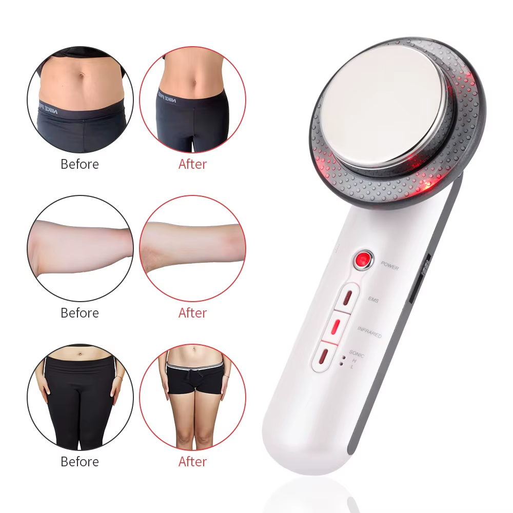 Maquina Facial de Ultrasonido